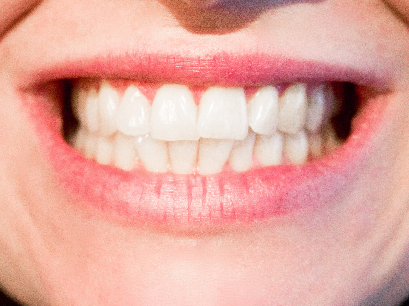 Female Smiling White Teeth